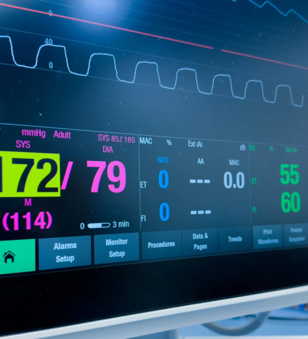 Monitoramento e Diagnóstico - ECCUS ENGENHARIA